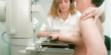 Demanda perquè les mamografies siguin gratuïtes sense límit d’edat