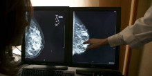 Es detecten 28 casos de càncer de mama des del gener del 2020