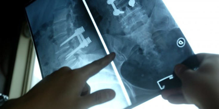 Un metge revisa unes radiografies obtingudes mitjançant una ressonància magnètica.
